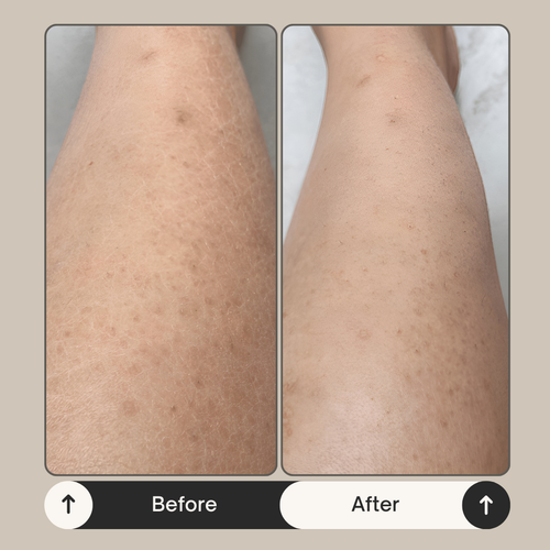 Lysa Skin Volcanic Glow Face & Body Scrub