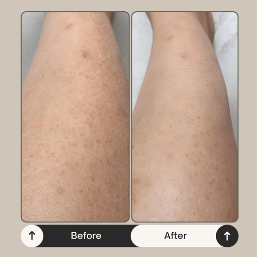 Lysa Skin Volcanic Glow Face & Body Scrub